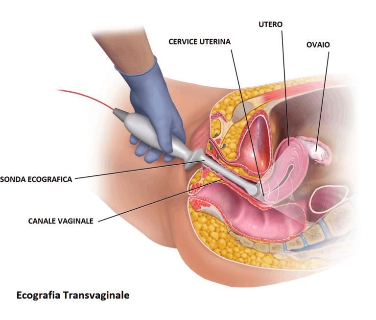 ecografia-ginecologica-interna